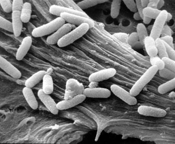 Batteri La microflora batterica presente negli alimenti può essere suddivisa in due principali categorie: Ø Alterante (batteri saprofiti) Ø Patogena Al primo gruppo appartengono batteri non patogeni,
