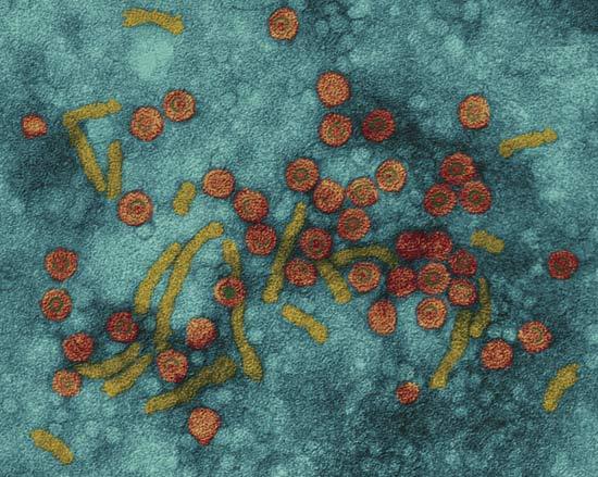 v Astrovirus q virus delle epatiti a trasmissione