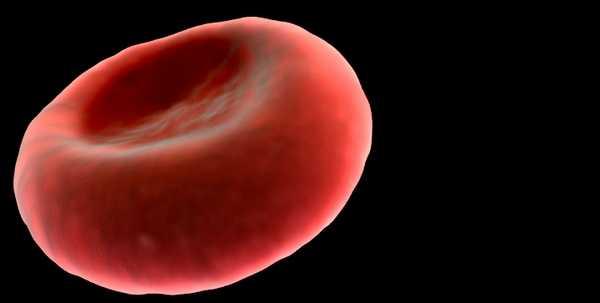 ANEMIA E una ridotta concentrazione di globuli rossi ed emoglobina nel sangue Nelle malattie reumatiche, e