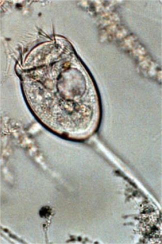 LA VORTICELLA La Vorticella è un ciliato unicellulare a forma di campana, attaccata al fondo per mezzo di un peduncolo retrattile.