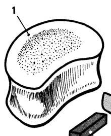 Modello di formazione di una vertebra tipo In ciascuna vertebra si riconoscono: Il corpo Il corpo, impari, è formato da osso spugnoso, ha forma cilindrica appiattita in senso antero-posteriore.