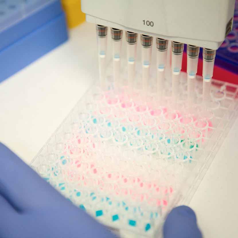 CARIOTIPO MOLECOLARE L analisi array-cgh in epoca prenatale è un test diagnostico che identifica possibili alterazioni genomiche del feto utilizzando DNA estratto da prelievo invasivo.