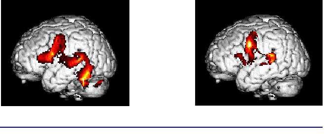 Ci sono tonnellate di documenti prodotti dalla ricerca che dicono che la dislessia non è una malattia, ma l espressione di una piccola differenza di alcune aree del cervello che non