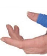 della mano 9 Splint statico per patologie di pollice ORFICAST I tutori della mano vivono una