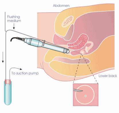 - Consulenza genetica - Set-Up diagnostico preclinico -