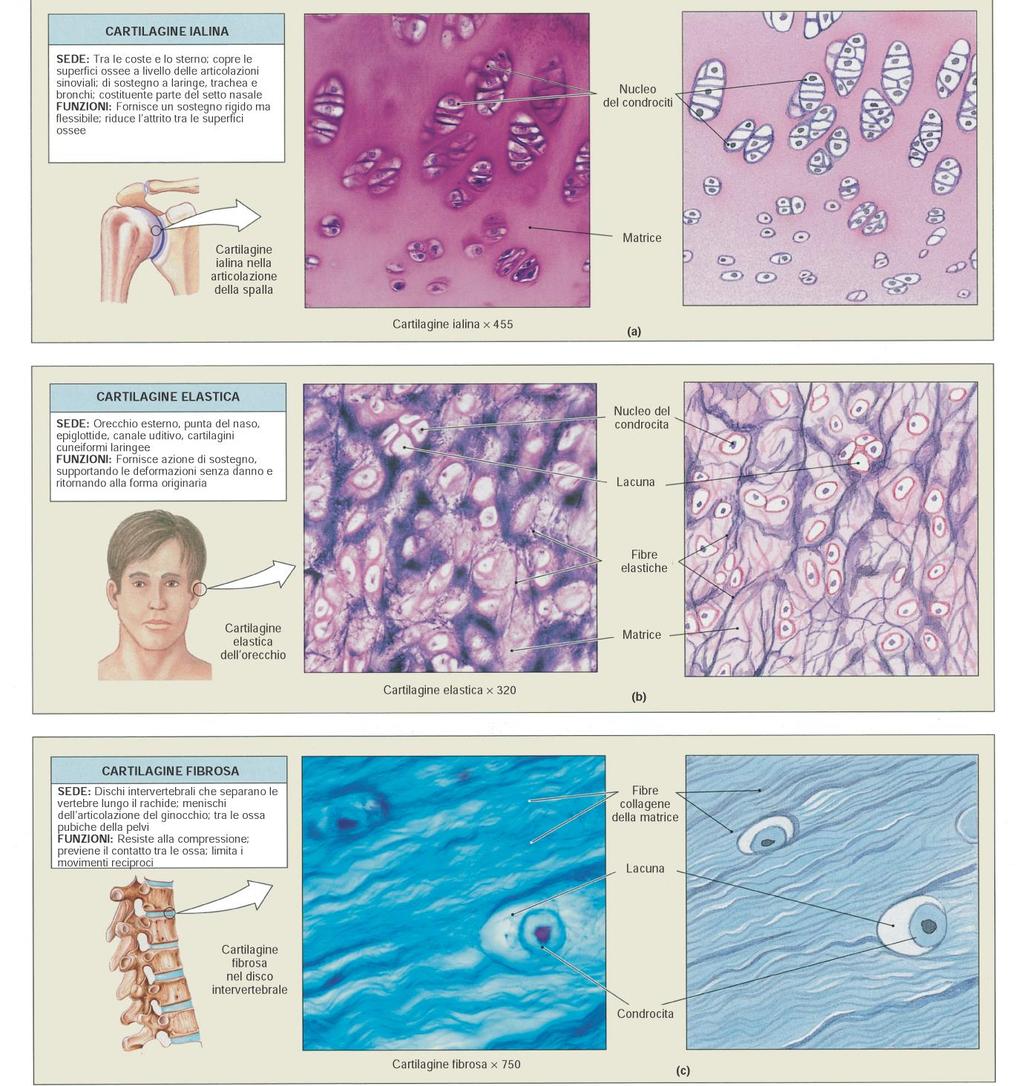 TIPI DI CARTILAGINE IALINA: Articolazioni sinoviali Sostegno a laringe, trachea e bronchi Costituente del setto nasale, coste (Scheletro fetale) Sostegno rigido ma flessibile Fibre collagene