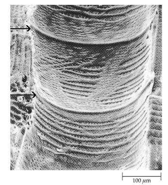 Una serie di trachee disposte in pila danno luogo a un vaso xilematico con bassa resistenza al flusso di