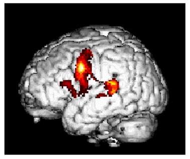 Attivazione cerebrale durante compiti di lettura Controlli network