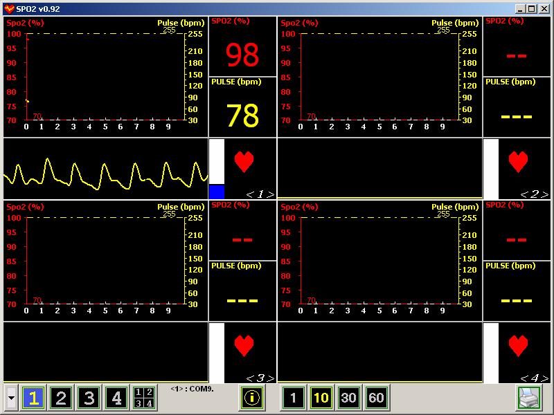 Monitoraggio real time E possibile eseguire il monitoraggio in tempo reale della saturazione di ossigeno e della frequenza cardiaca, con il pulsossimetro collegato al personal