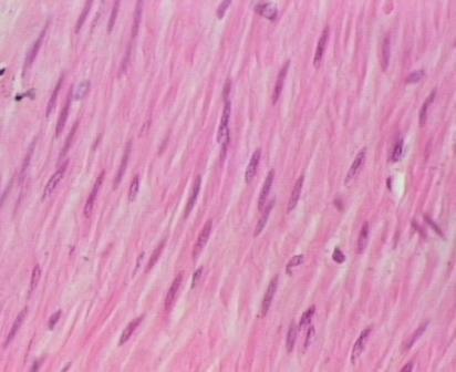 TESSUTO MUSCOLARE LISCIO Le cellule muscolari lisce (smooth-muscle cells) hanno la forma di piccoli fusi di circa 20-200 mm di lunghezza e soltanto 2-10 mm di diametro.