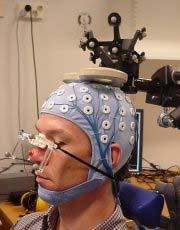 TMS / stimolazione magnetica transcraniale Bobina di stimolazione posta sulla superficie della testa Tecnica nuova, non invasiva Produzione di un campo magnetico che produce attivita elettrica nel