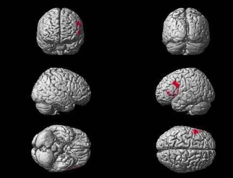 fmri normal