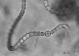 AlgheazzurreCyanobacteria, Organismiprocario<ciunicellulari Morfologiavariabile:unicellulari(acoccoobastoncino)immobili; filamentoseoramificatefinoa200µm,capacidimuoversiper scivolamento