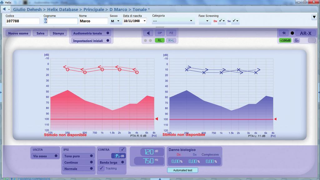 AUDIOMETRIA TONALE Audiometria tonale in pochi clic Con HERMES l audiometria tonale per via aerea, per via ossea o in campo libero è intuitiva e si esegue rapidamente, cliccando direttamente sull