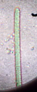Osservazione di Nostocales 1. Studio in vivo di altre alghe azzurre: Anabaena, Phormidium, Lyngbia, Oscillatoria.