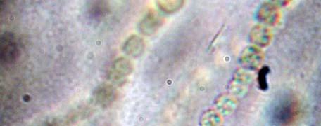 Il microscopio rivela l esistenza di numerose catenelle contorte