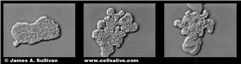 L APOPTOSI E E UNA FORMA DI