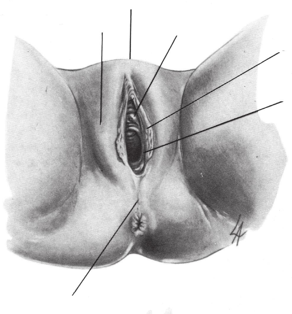 1 Anatomia grande labbro meato uretrale so monte di venere prepuzio piccolo labbro clitoride frenulo Un iv er resti dell imene vestibolo meato uretrale orificio della ghiandola di skene piccolo