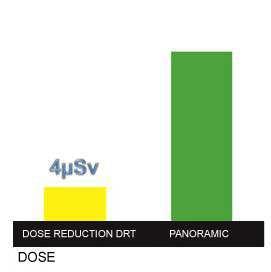 Versatilità La completezza dei programmi di acquisizione 2D e 3D offre un eccellente supporto per tutti i tipi di diagnosi.