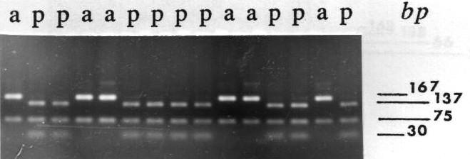 Analisi di restrizione: un esempio DNA individuo 1 PCR Amplificazione di un frammento di DNA con 2 siti di taglio per l enzima Alu I 5'----------AGCT------------AGCT-------3'