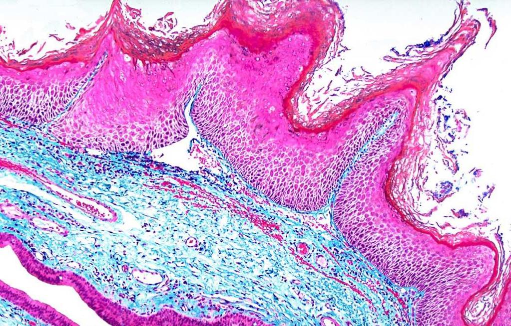 Tessuto periendoteliale Stroma di organi ghiandolari, di organi linfoidi e del midollo osseo Colorabili con coloranti