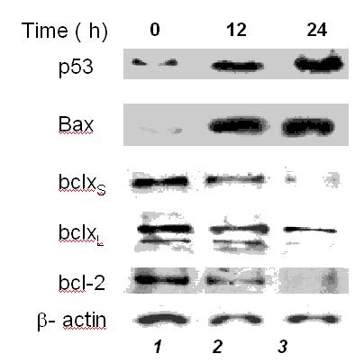 ESEMPI DI WESTERN BLOT E