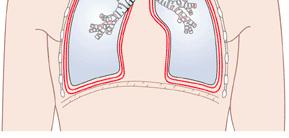 I Polmoni Ogni polmone è circondato da una doppia membrana chiamata pleura.