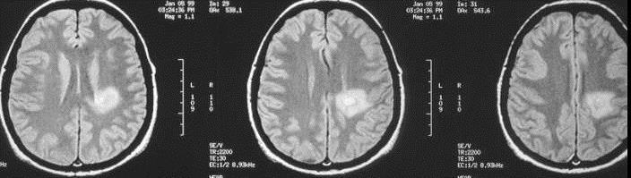 diagnosi differenziali 7.