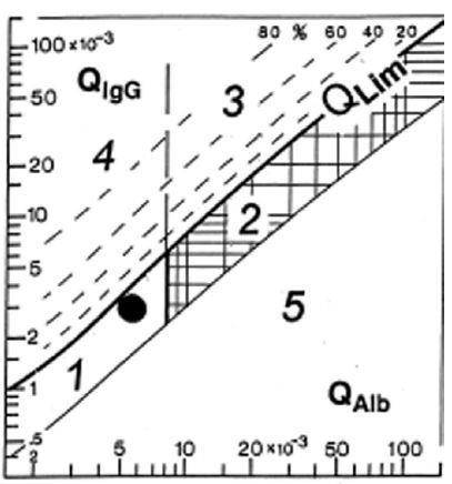 L espressione quantitativa della sintesi intratecale di IgG si ottiene utilizzando funzioni non lineari (iperboliche), come la formula di Reiber, oppure lineari (Formula di Link) Formula di