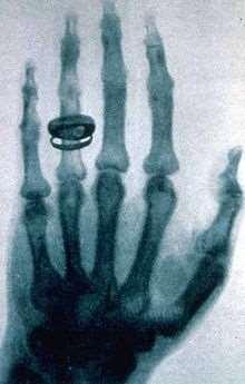 Radiologia : Scienza Giovane La Radiologia ha una data precisa d inizio. L 11 Novembre 1895 C.W.