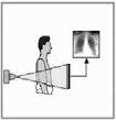 TC L esame TC presenta molte analogie con una normale radiografia: un fascio di raggi x attraversa il corpo del paziente, l attenuazione dei raggi x nei tessuti dipende dallo spessore e dalle