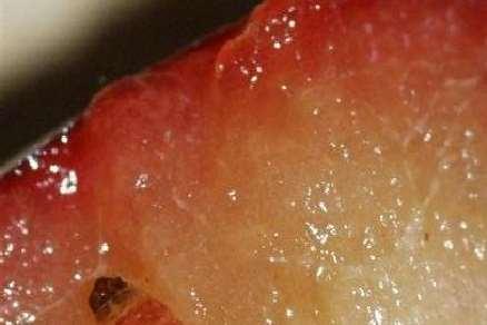 Verme delle noci (Cydia pomonella): lepidottero causante cascola anticipata dei frutti, attività carpofaga sul gheriglio anche in post-raccolta nelle noci immagazzinate.