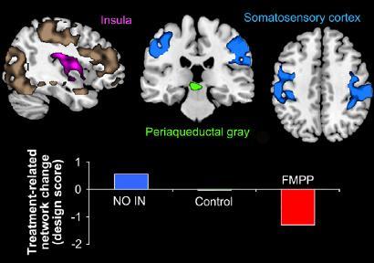 Three regions of interest selected from the network for study in the resting state are highlighted in pink