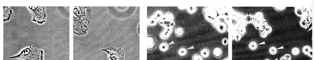 Morfologia Cellule embrionali di criceto normali (a, b) paragonate a quella di cellule trasformate (c, d).