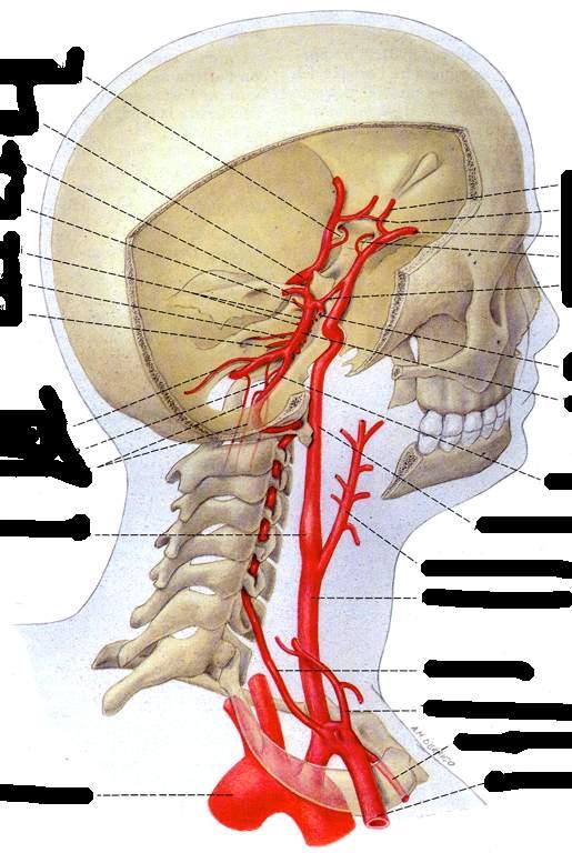 Processo clinoideo anteriore sinistro A. carotide interna sinistra A. cerebrale posteriore sinistra A. cerebellare posteriore sinistra Rami pontini sinistri A. uditiva interna sinistra A.
