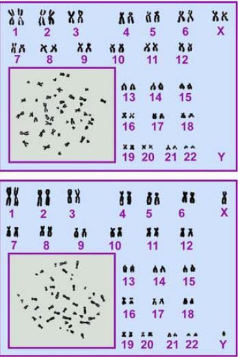 Il cariotipo Si può arrestare la mitosi in metafase con colchicina e si possono esaminare i singoli cromosomi per classificarli in base a differenze di dimensione e forma (analisi del cariotipo)