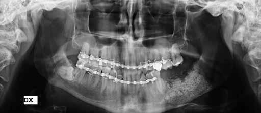 Chirurgia orale Fig. 7.