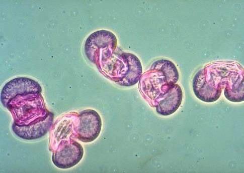 ) facilmente osservabili con un microscopio.