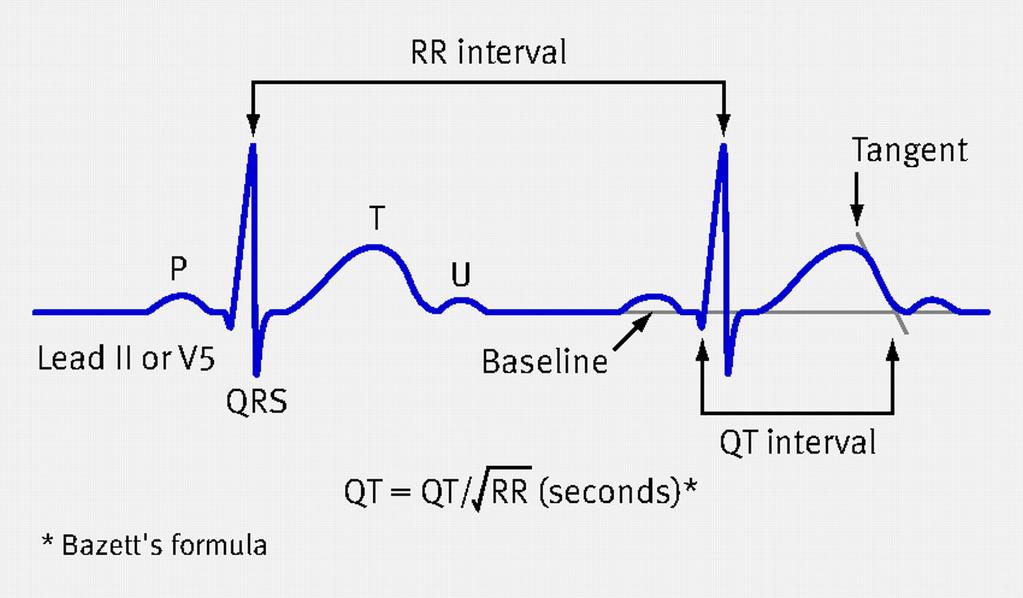 LONG QT SYNDROME LQTS Disturbo della ripolarizzazione miocardica caratterizzata all ECG da un prolungamento dell intervallo QT Associata ad un aumentato rischio