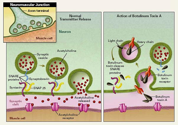 Tossina Botulinica: meccanismo d azioned Blocco reversibile liberazione ACh (a livello delle sinapsi colinergiche)