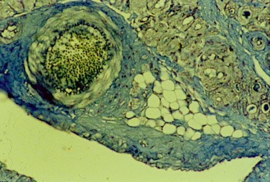 Le fibre collagene formano una rete di fasci spessi ed ondulati, nelle cui maglie sono alloggiate poche