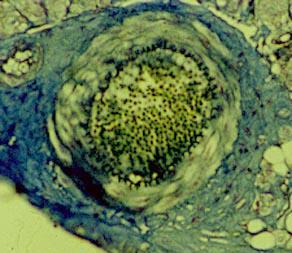 Tessuto elastico: -sebbene presenti come tipo cellulare predominante i fibroblasti, le fibre maggiormente