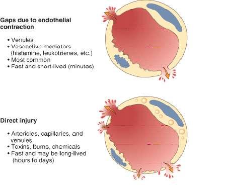 Formazione dell essudato: principali meccanismi di aumento della permeabilità Contrazione cellule endoteliali - Venule - Mediatori vasoattivi