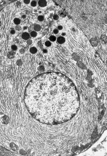 Cellula pancreatica a secrezione sierosa (TEM). Nucleo eucromatico.