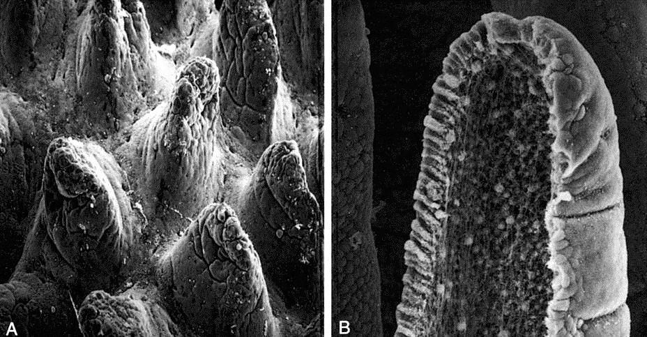 Villi intestinali in