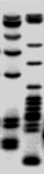 DNA fingerprinting Tecnologia che consente la discriminazione tra individui nonché l identificazione univoca di singoli individui di una
