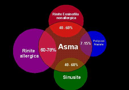 Asma - Rinopatie Sinusiti Associazione Nei pazienti asmatici deve essere