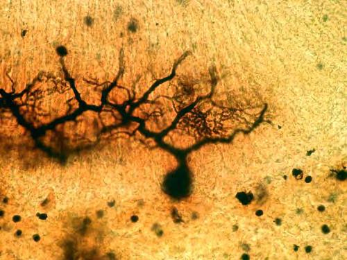 Le cellule del Purkinje sono localizzate nella corteccia del cervelletto: pirenoforo a forma di pera, da cui si staccano un lungo assone (che