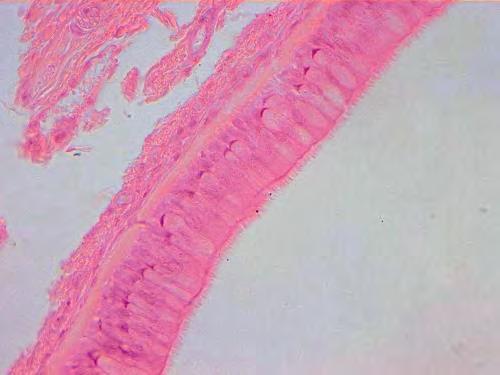 Epitelio pseudostratificato cigliato Trachea, Epitelio pseudostratificato cigliato.