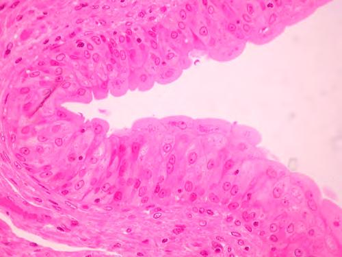 Epitelio della vescica Epitelio di transizione (pseudostratificato). Vescica urinaria di Mammifero nello stato rilasciato (vescica vuota).